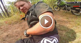 2 motorcycles crash..broken arm